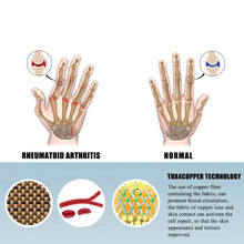 Load image into Gallery viewer, Comparison of rheumatoid arthritis and normal hand with copper fabric technology illustration.
